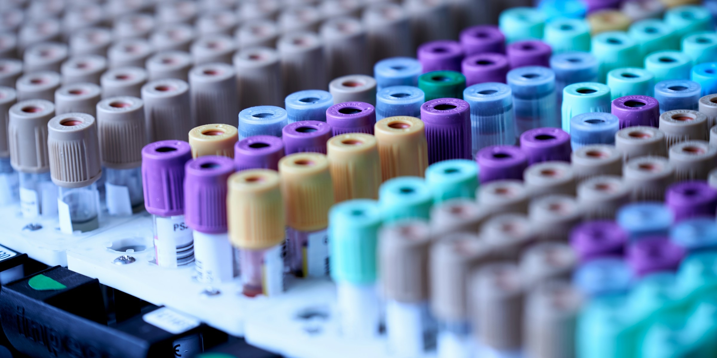 анализ на сердечно сосудистые риски бесплатно