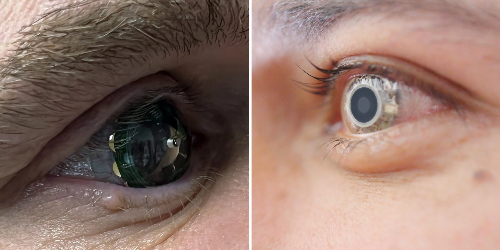 Умные линзы Mojo Lens и Azalea ALMO