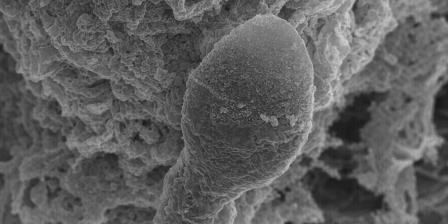 Пока никаких детей в космосе: учёные выяснили, что сперматозоиды теряются в микрогравитации